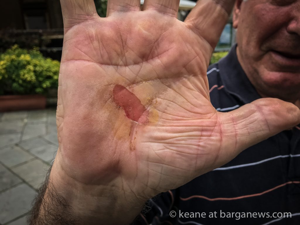 Daily Image – 17th October 2018